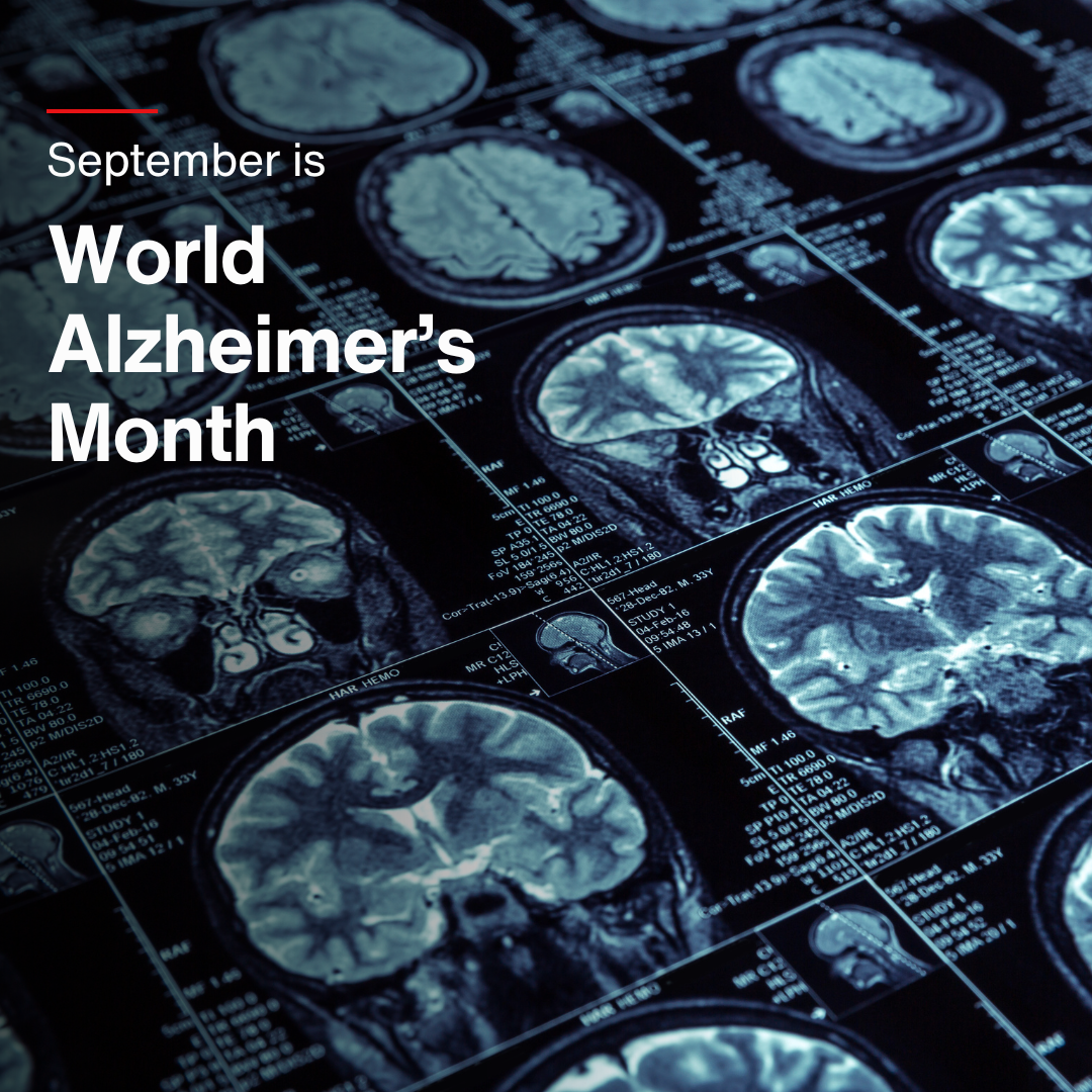  Discover how Thermo Fisher supports World Alzheimer's Month through cutting-edge research, innovative solutions, and partnerships aimed at advancing Alzheimer's care and finding novel treatments.
