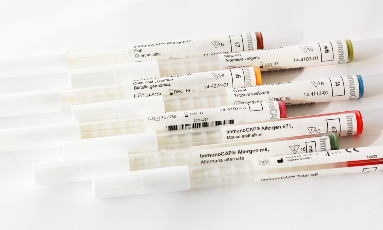 ImmunoCAP Blood Tests