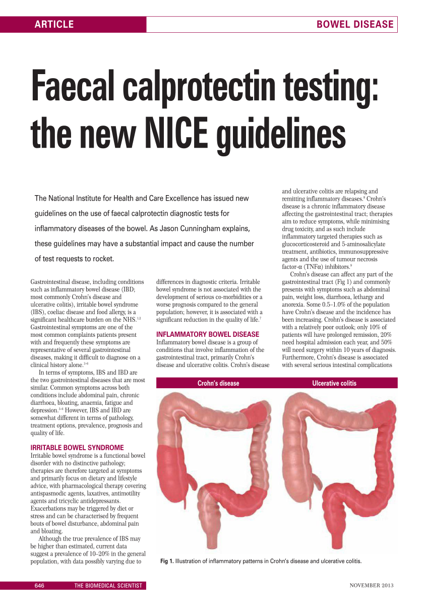 Faecal-calprotectin-testing-the-new-NICE-guidelines